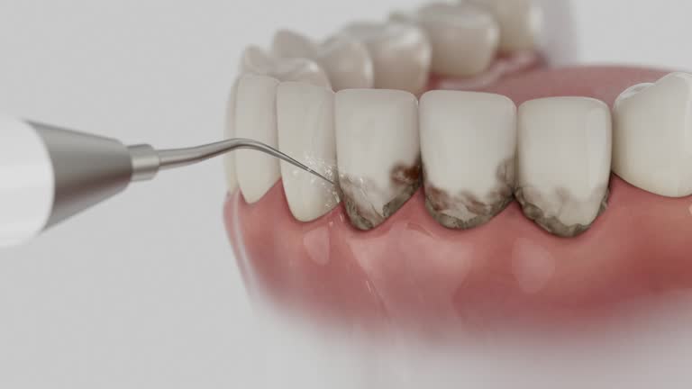Reliable Emergency Dentist contractor in Savage, MD by Smile Center Dentistry